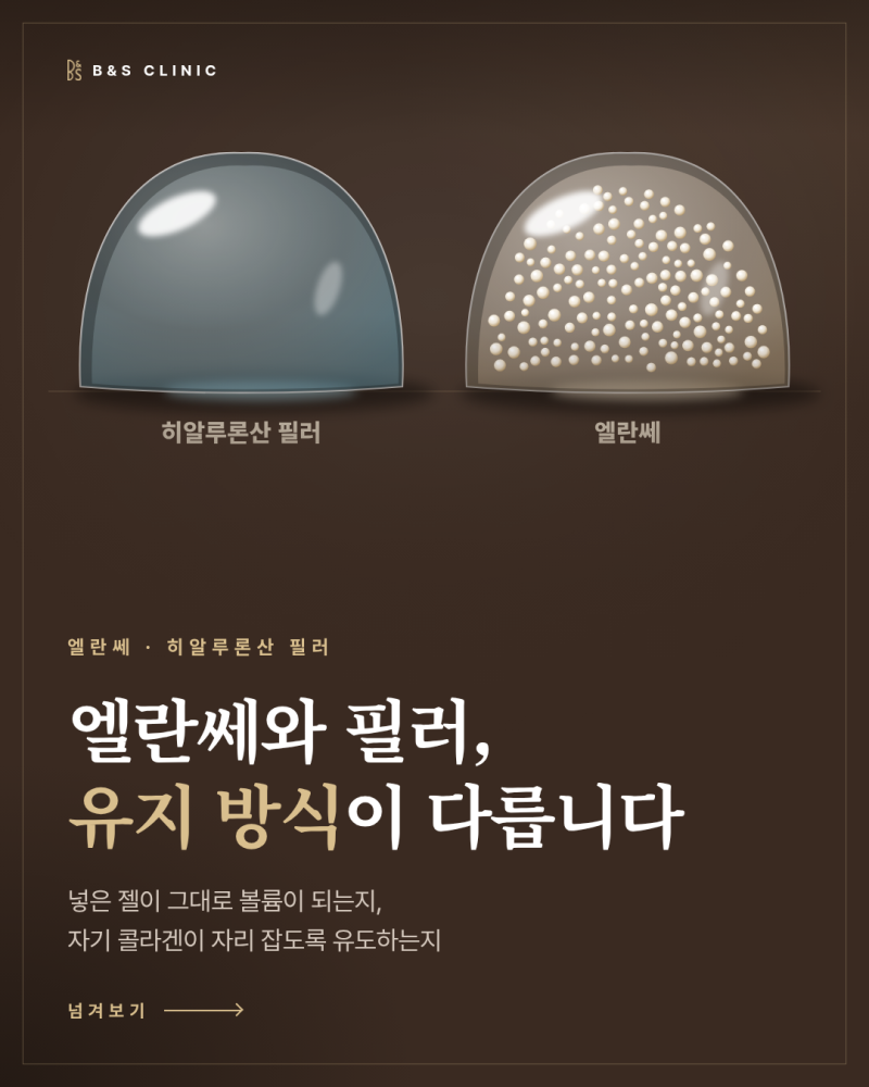 엘란쎄와 필러의 차이, 채운 볼륨을 무엇이 유지하는지부터 살펴봅니다