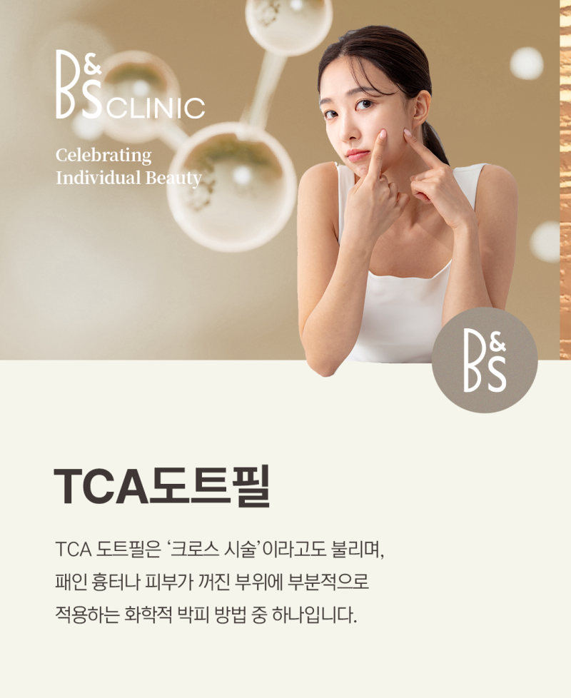 강남구흉터치료, 패인 자국 개선에 도움이 되려면
